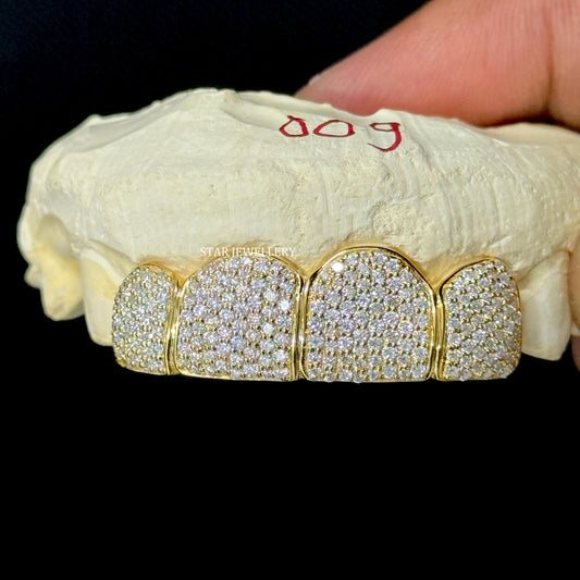 VVS Moissanite 925 Sterling Silver Diamond Grillz