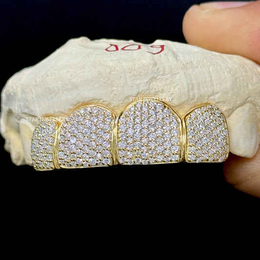 VVS Moissanite 925 Sterling Silver Diamond Grillz